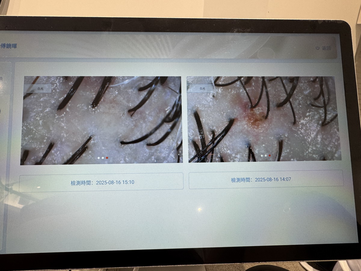 【生活】初生生專業頭皮養護中心 2025:幫頭皮做健康檢查和Spa,專業的頭皮保養店,頭髮需要呵護,頭皮也需要照顧 7058 【生活】初生生專業頭皮養護中心 2025:幫頭皮做健康檢查和Spa,專業的頭皮保養店,頭髮需要呵護,頭皮也需要照顧 7058